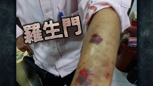 高雄選舉暴力!助選員被打到胸臂挫傷 現任里長挨告反控「自導自演」