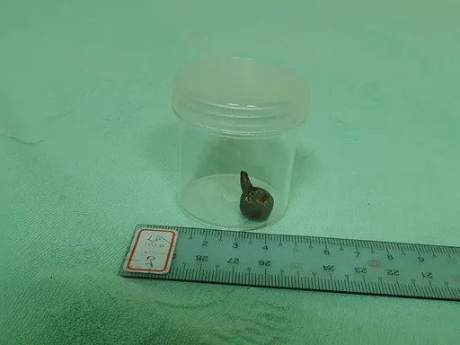 阿嬤假牙19天人體驚奇之旅　嘴、胃、膀胱！然後自然排出