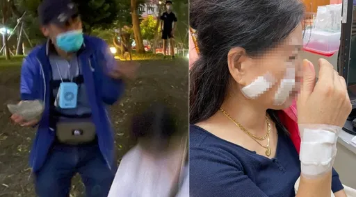 女子在天母公園內抽菸　這老翁太狂妄！直接重拳伺候外加石頭攻擊