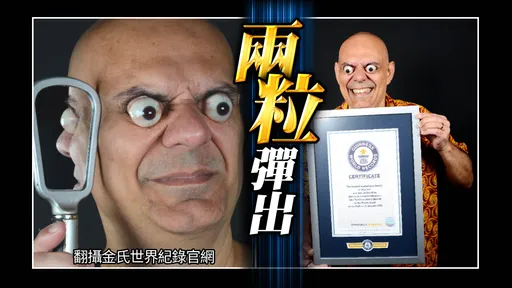 眼睛脫窗真的存在！　巴西凸眼哥完美重現「眼睛脫窗」