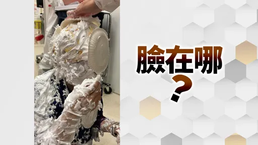 人緣超好護理師 生日這天超慘!萬人看照片驚呆「哪邊是臉?」