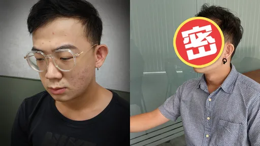 讓前女友後悔！痘花臉宅男靠台酒「抗痘」 對比超驚人！