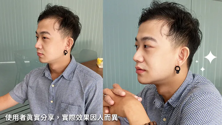 男子肌膚狀態大躍進，從自卑痘花男變信義區人氣王。