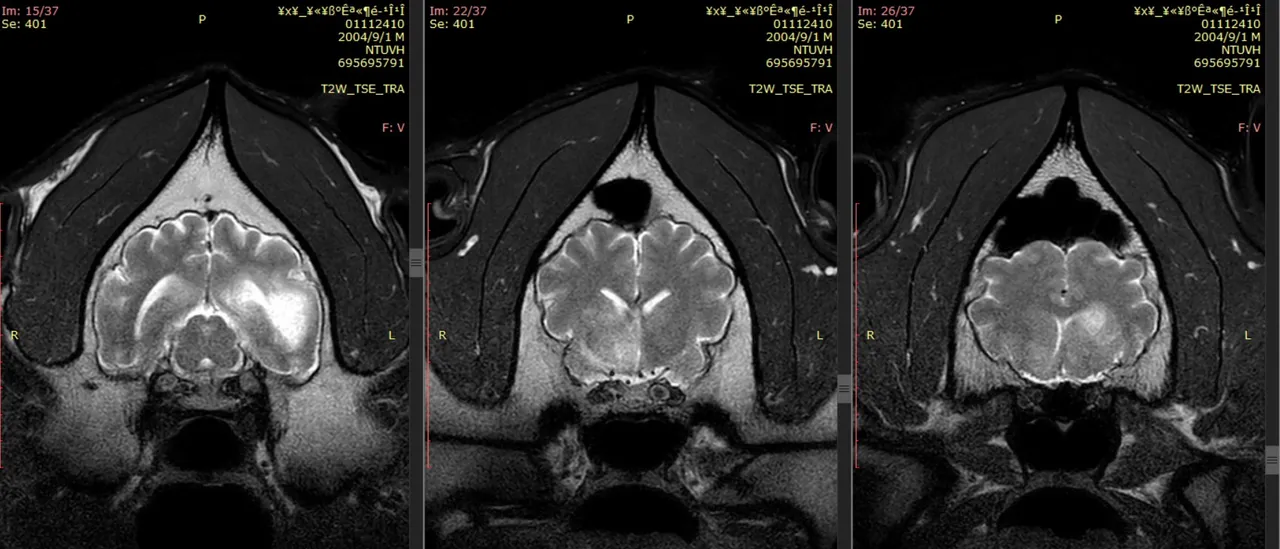 團團第2次MRI(磁振造影)影像顯示腦部病變病灶區域擴大。動物園提供