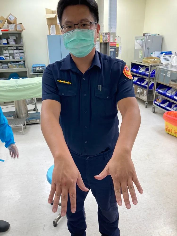 顏姓警員被醉漢揮拳打傷臉部及雙手。讀者提供