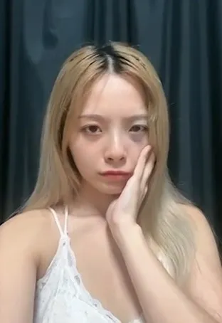 不少人認為正妹清純也很美，還有人以為她畫眼妝，其實這是胎記。TikTok:jj.ii.ee.1223 授權使用