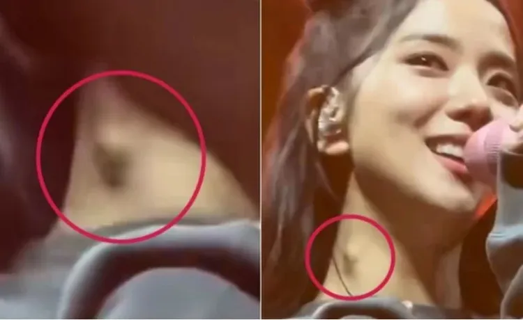 Jisoo脖子上有一個腫塊，令人擔心健康狀況。翻攝naver