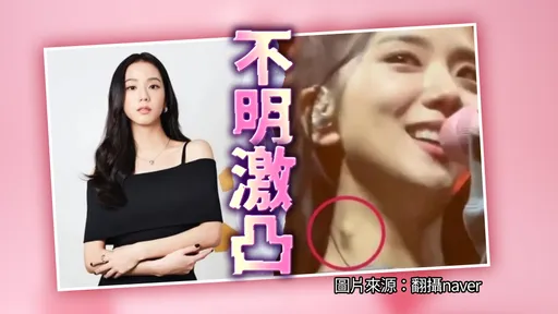 Jisoo脖子驚現10元硬幣大腫塊 忙巡演粉絲心疼促就醫檢查