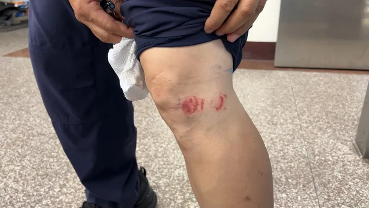 遭拖行警員所幸沒有大礙，但身體也因此多處擦挫傷。田兆緯攝