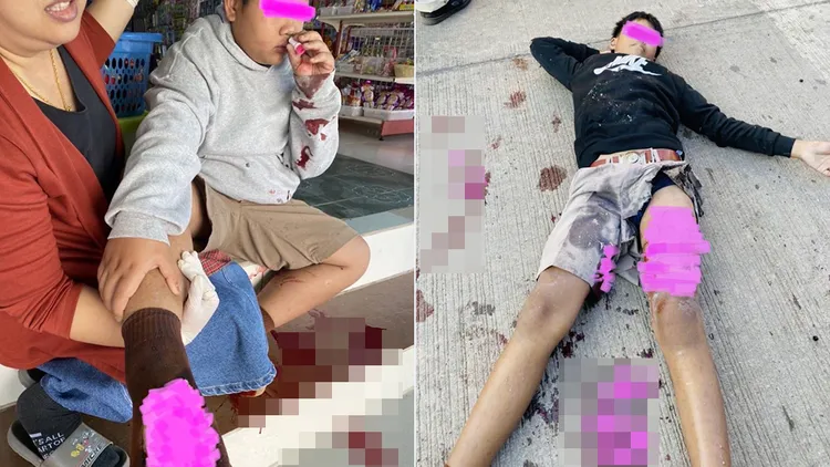 踢人和被踢男童都受傷鮮血直流。翻攝自《THAILAND POSTS》