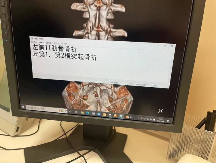 Matt車禍骨折，目前休養中。翻攝Matt IG