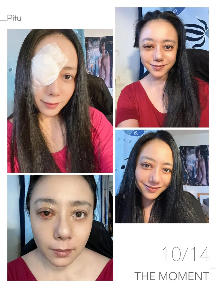 高慧君手術當天竟有10分鐘麻藥無效，她忍痛熬過，她說做了不好示範。翻攝高慧君臉書