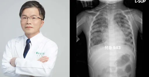 RSV狡猾比新冠更兇險還有「免疫債」! 醫籲家長留心8症狀 「2招能堤防」