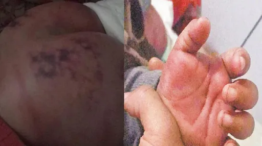 愛的小手狠抽18下 台中3歲童臀手瘀青!下手「丹丹叔叔」慘了