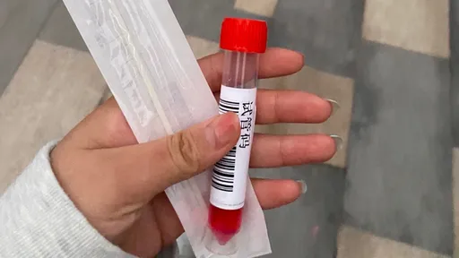 请捅我！阿伯1天狂做18次筛检　不做就难受「全身发痒」