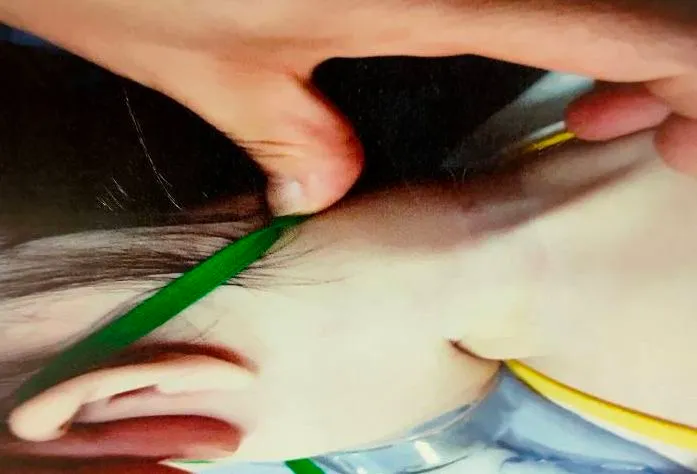 媽媽說，孩子送醫時頸部有擦傷。家長提供