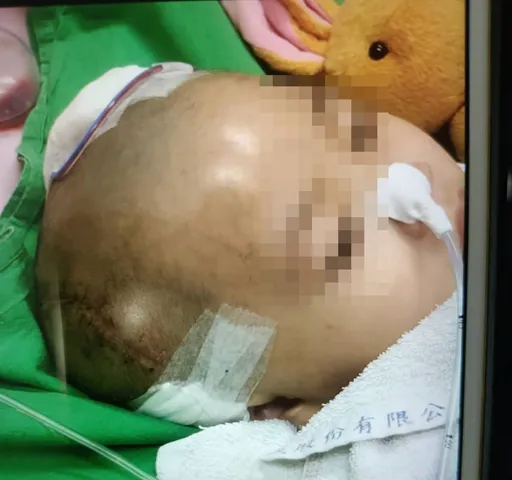 可憐!5歲童遭虐半癱眼盲 惡保母夫妻「倒吊逼喝尿」還拍照取樂