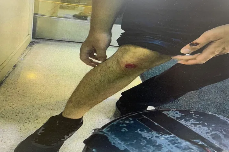 警員追捕時，不慎摔車受傷。翻攝畫面