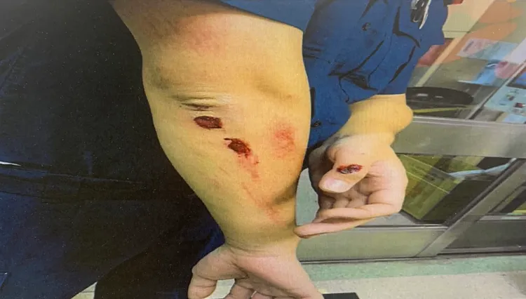 李男逃逸時刻意急煞，害得追捕警員摔車受傷。翻攝畫面