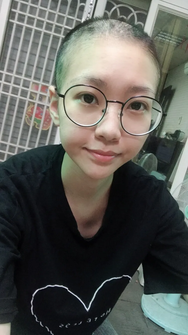張雨柔前年罹患卵巢癌，化療期間，曾一度掉成光頭。張雨柔提供