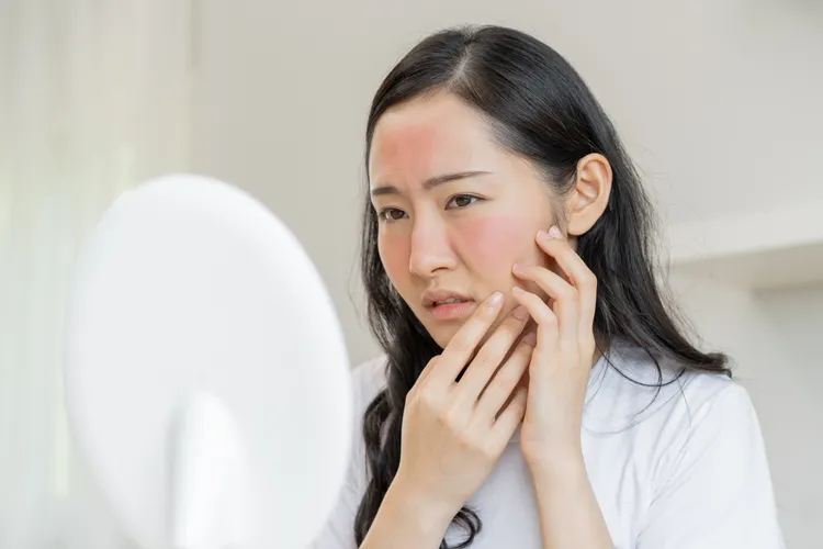 戴口罩悶住傷口，會使傷口紅腫、影響傷口癒合。主辦單位提供