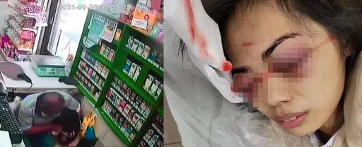 曾咬死狗又持刀砍人!惡男挖眼超商女店員還往死裡打 輕判定讞