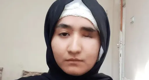 最美的眼睛！自殺炸彈擋不住求學的心　阿富汗獨眼少女通過入學考