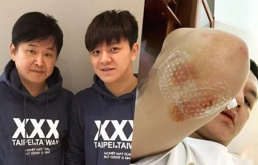 賀一航兒被汽車撞!頭差點被輪胎輾過 鼻孔狂流血水