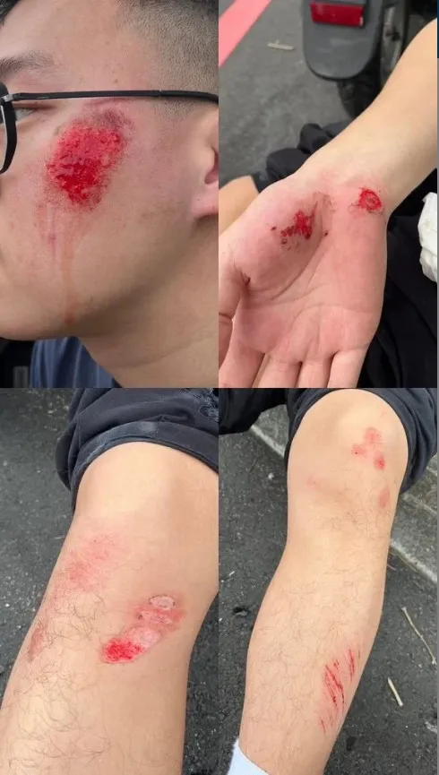 網友租共享機車，卻因安全帽擋風板連著遮陽板掉落遮蔽視線，害他失控摔車。當事人提供