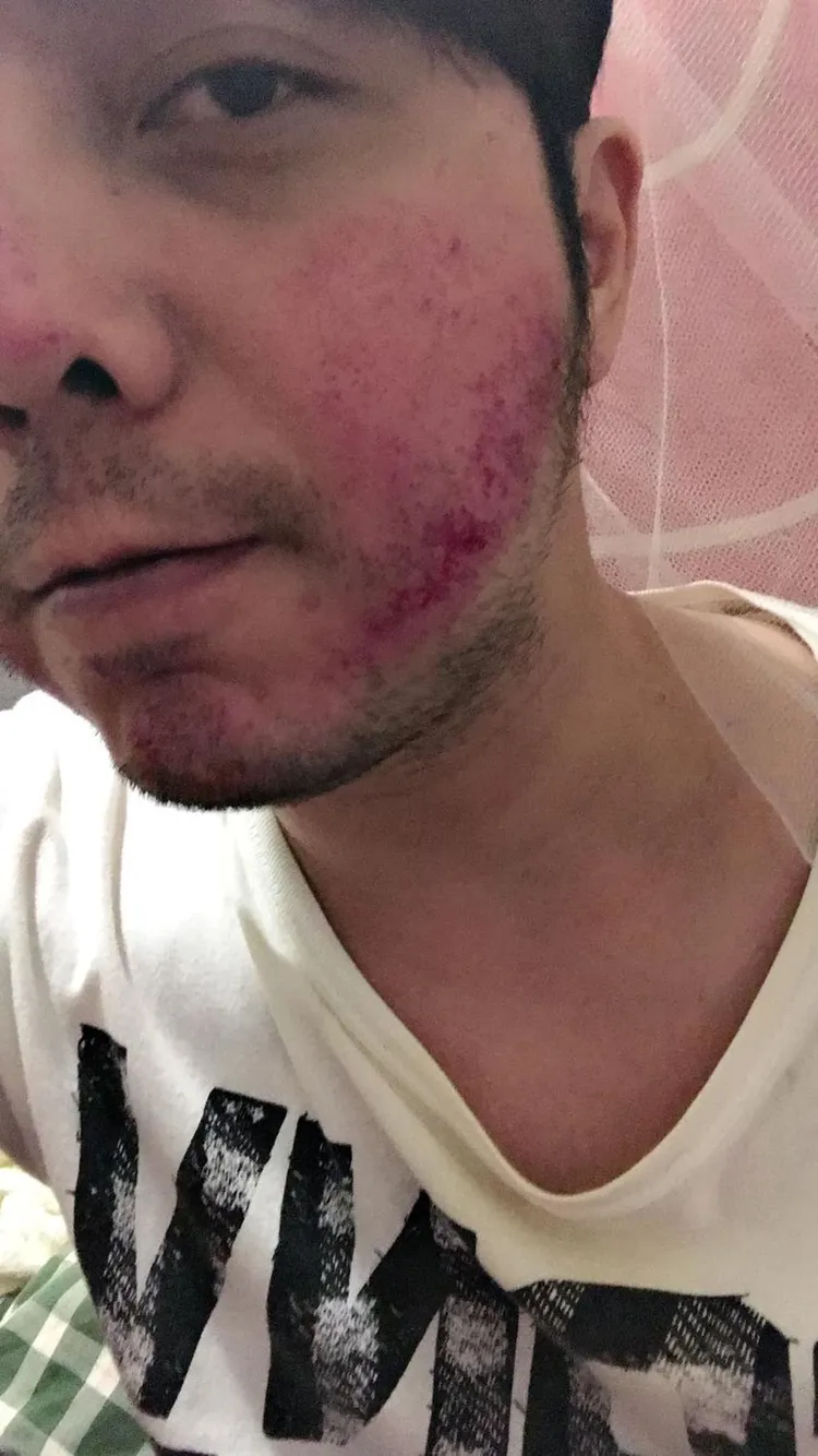 小炳為了哥哥和陌生人打架。翻攝自小炳臉書