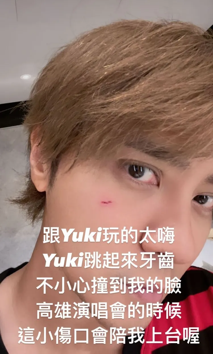 羅志祥透露受傷原因。翻攝羅志祥ｉｇ