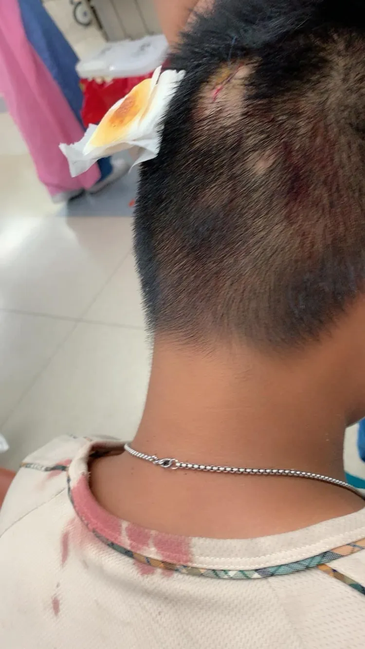 有網友貼出就讀國中孩子在學校被打破頭照。翻攝自臉書社團高雄五甲大小事