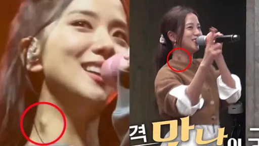 2年前就出狀況！BLACKPINK Jisoo脖子驚見不明腫塊　經紀公司回應了