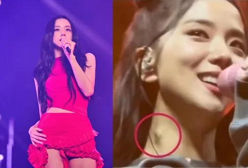 Jisoo美國巡演（右圖）上被拍到脖子有10塊硬幣大小的突出物，但公司表示她的健康沒有問題。翻攝YG娛樂、YouTube