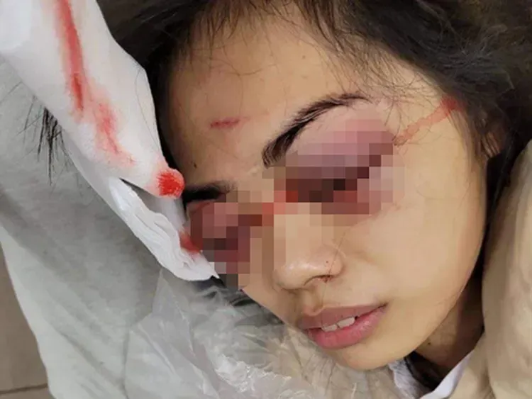 被攻擊的潘女，送醫治療影像。民眾提供