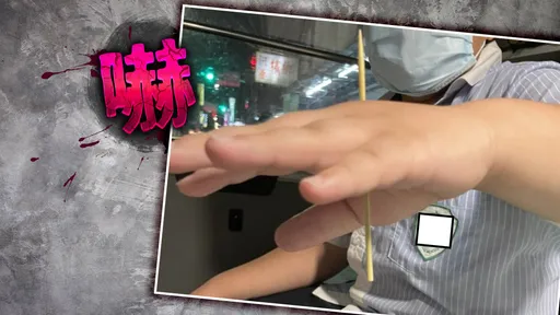 9歲童猛拍垃圾袋爆破　10公分竹籤瞬間貫穿手掌！傷勢曝光