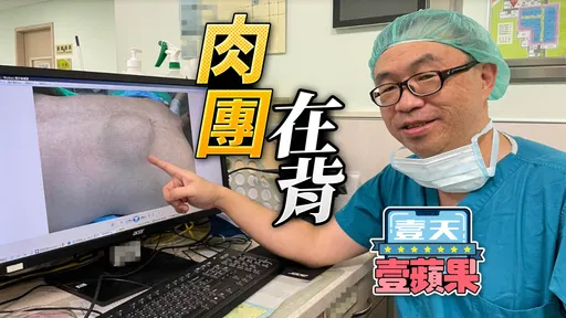 「姊姊背著肉丸丸」微創切掉8公分脂肪瘤　美魔女開心再穿緊身衣