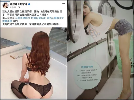 雞排妹新婚哭哭！po文「抽脂做壞了」挨告　法官看完整本寫真集判她要賠90萬
