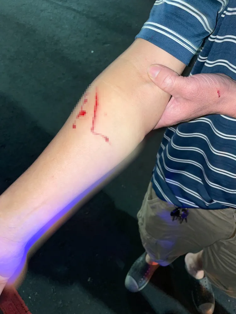 李姓運將右手臂遭劃傷2刀。淡水警分局提供