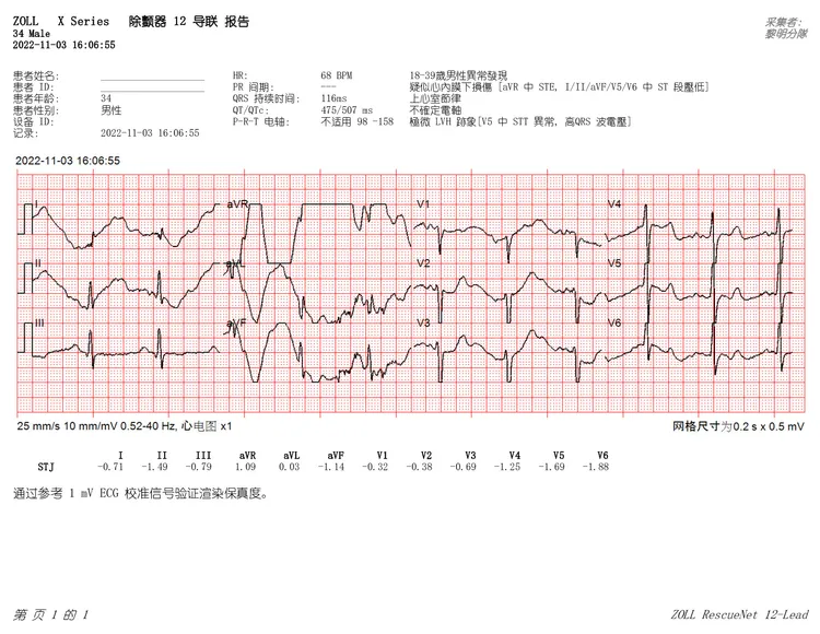 患者經檢測發現有「致命型心律不整」。台中市消防局提供