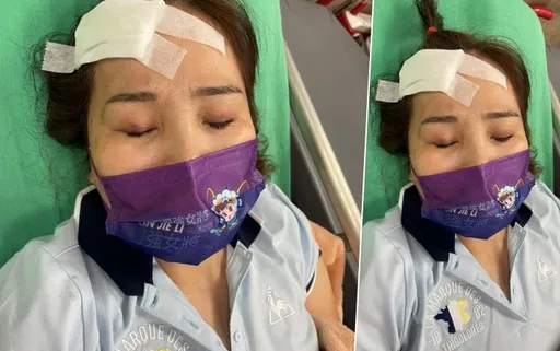 議員候選人林婕麗被攻擊!腦震盪鮮血淋漓、右肩骨折緊急送醫