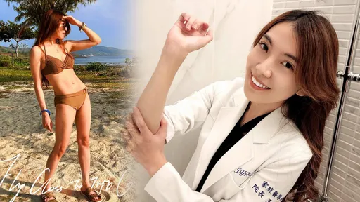 美女醫師慶生低頭吹蠟燭 下一秒「瀏海直接燒起來」她淡定反應被狂讚