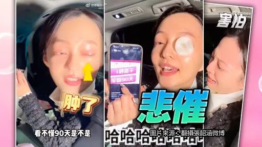 買到三秒膠?張韶涵假睫毛2小時卸不掉 腫眼哭訴助理天兵