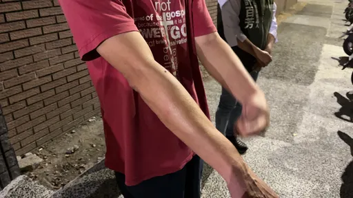 許百芳志工遭棍毆怒控對手施暴　警找到人「私人恩怨與選舉無關」