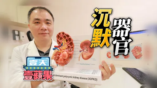 腰痛發燒檢出「腎長水泡像葡萄」　退伍蛙人超養生竟差點洗腎