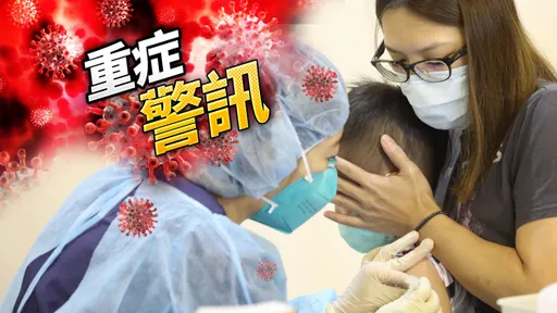 中重症+66　3歲童抽搐3天支氣管肺炎住加護