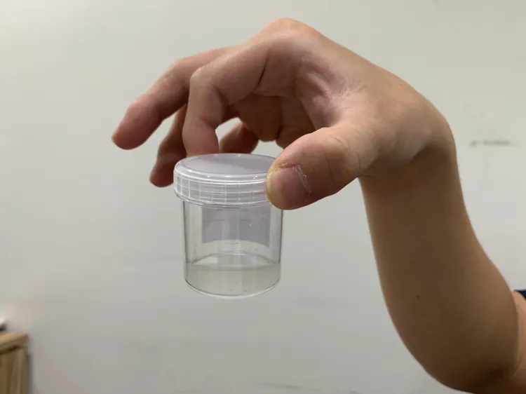 經蘇信豪醫師檢驗男子精液，發現裡面精蟲數極低。示意畫面