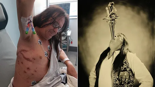 吞劍大師「嘴插5劍刺穿內臟」險死　不再吞劍！現在吞食物都不能