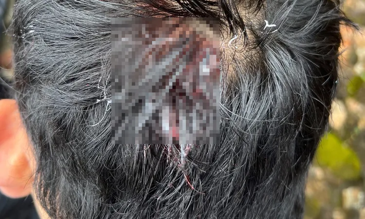 有山友頭部遭到落石砸中，導致頭部師裂傷。民眾提供