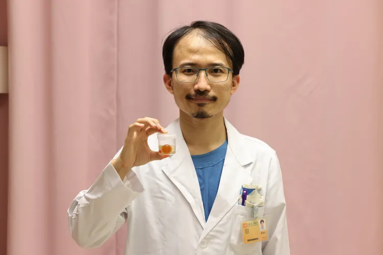 蔡逸文醫師手持經由手術，剖開男童小腸所取出的水晶寶寶。侯昌騰攝